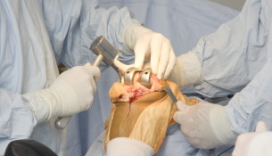orthopedic surgery md salaries
